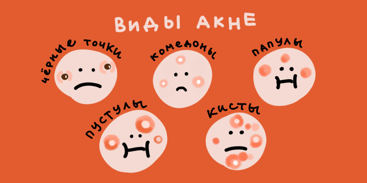 Виды акне